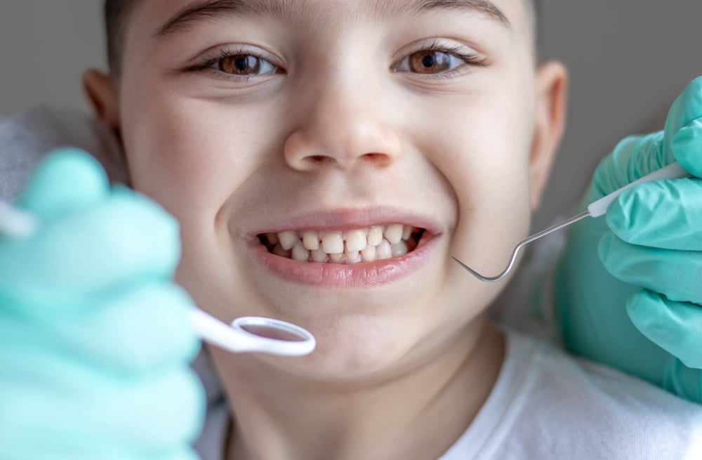 Pediatric dentist performing dental checkup on smiling preschool boy using mouth mirror, explorer probe, and scaler to examine diastema gaps.