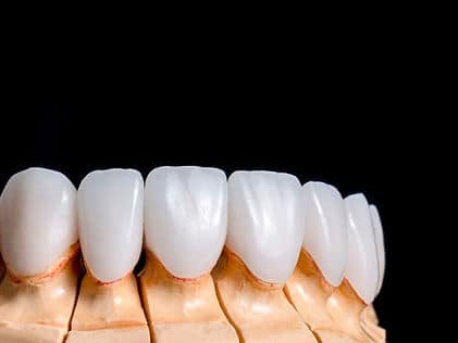 Image-empty-state-3-1 Dental Crowns & Dental Bridges Calgary AB